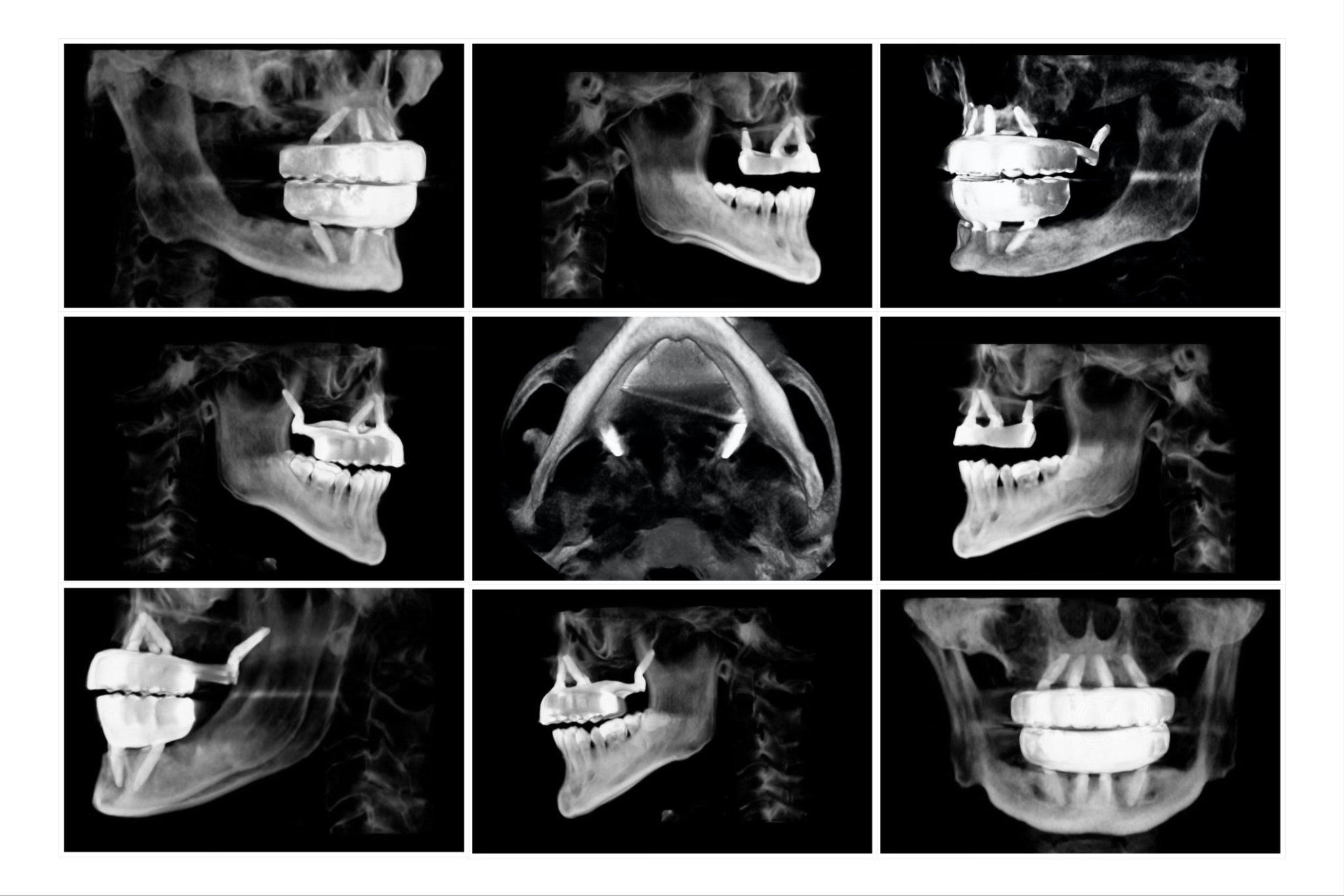 Arch Goals: A Master Guide to Your First 1000 Arches - AOX Surgery